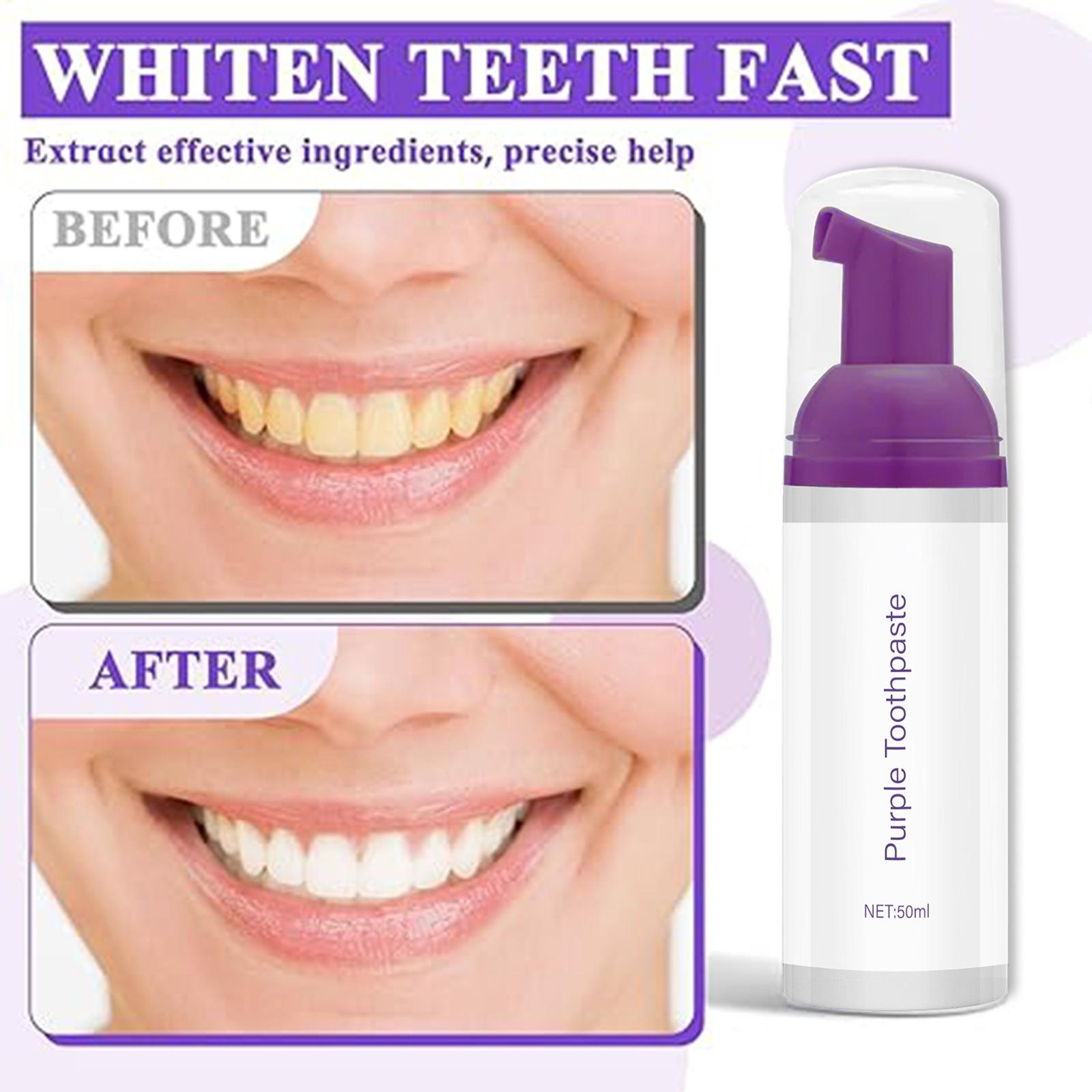 Teeth Whitening Before And After - 50ml Foam Toothpaste Brightening Deep Cleaning