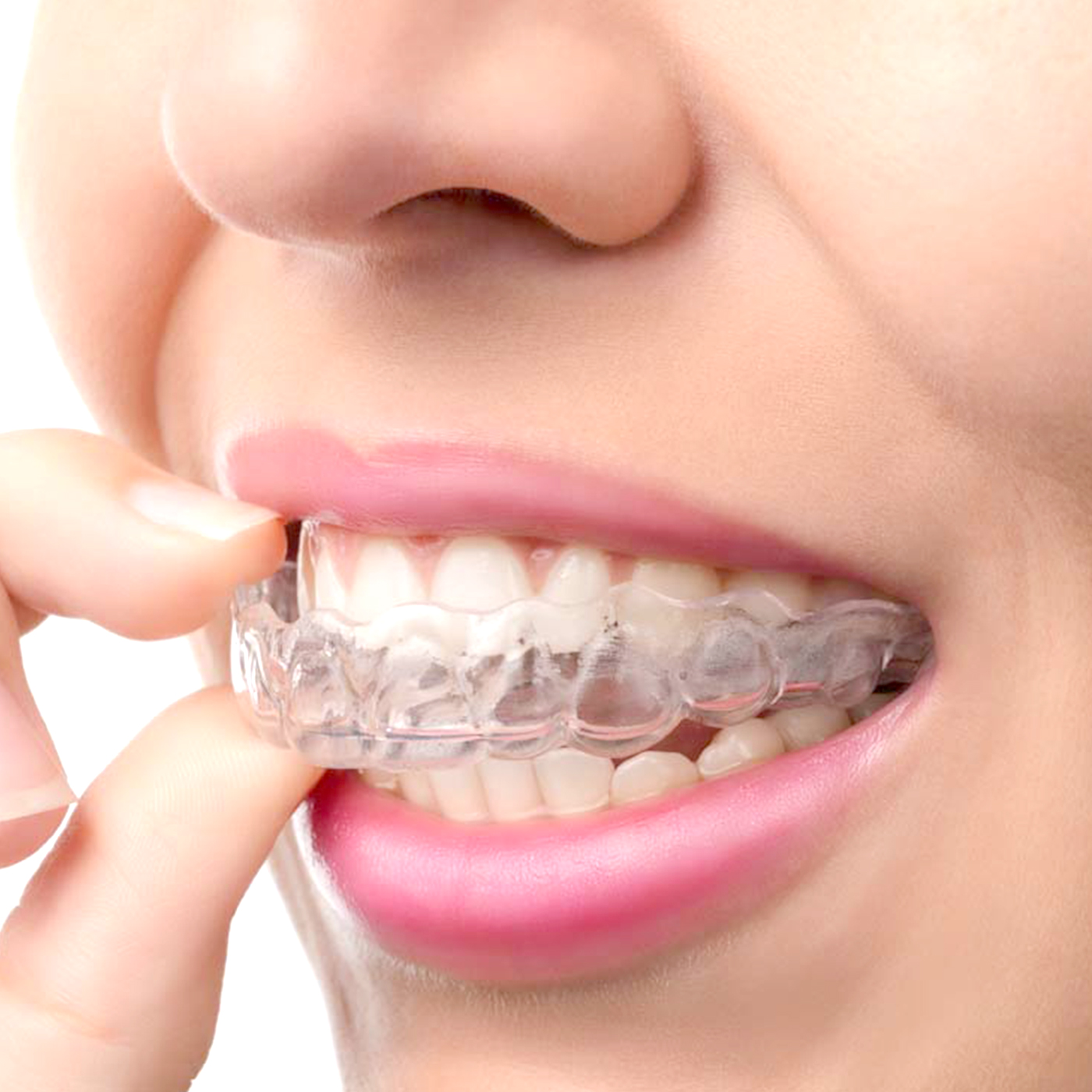 1Pc/2Pcs Transparent Teeth Tra - Teeth Whitening Mouth Guard 리뷰 및 가격