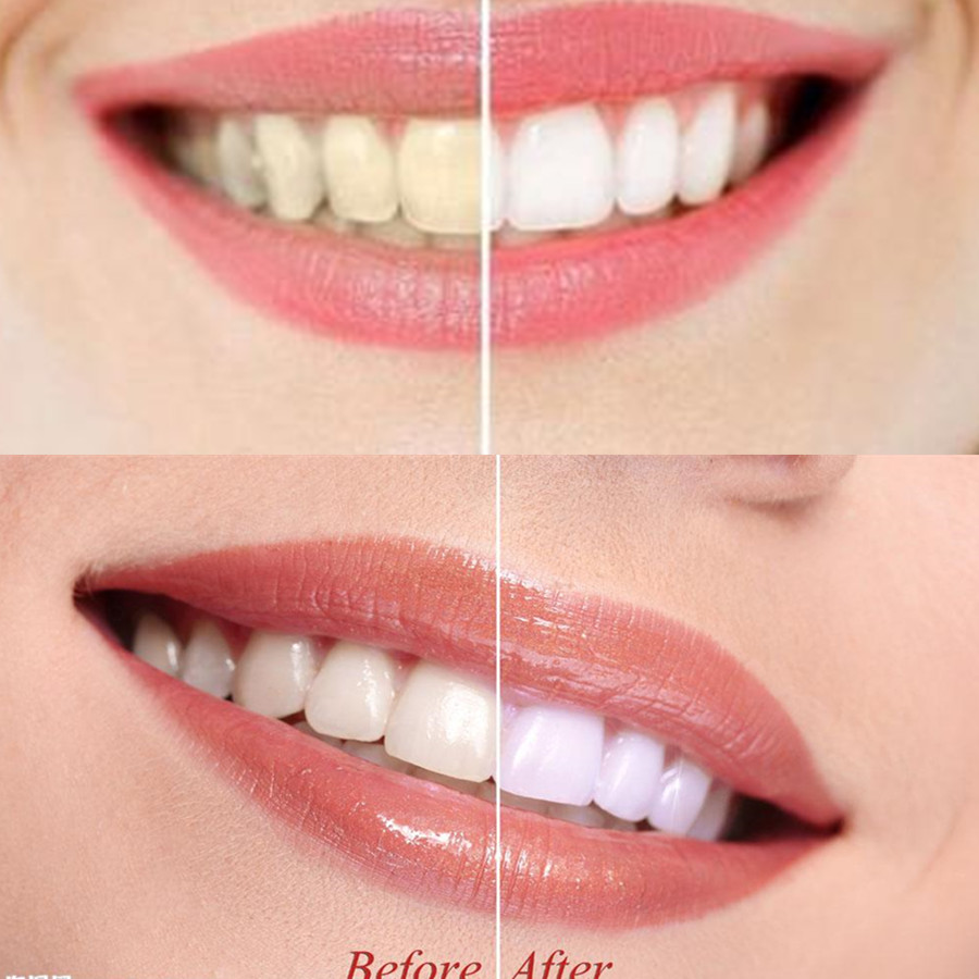 Bamboo Charcoal Teeth Tooth De - Teeth Whitening Filter 리뷰 및 가격