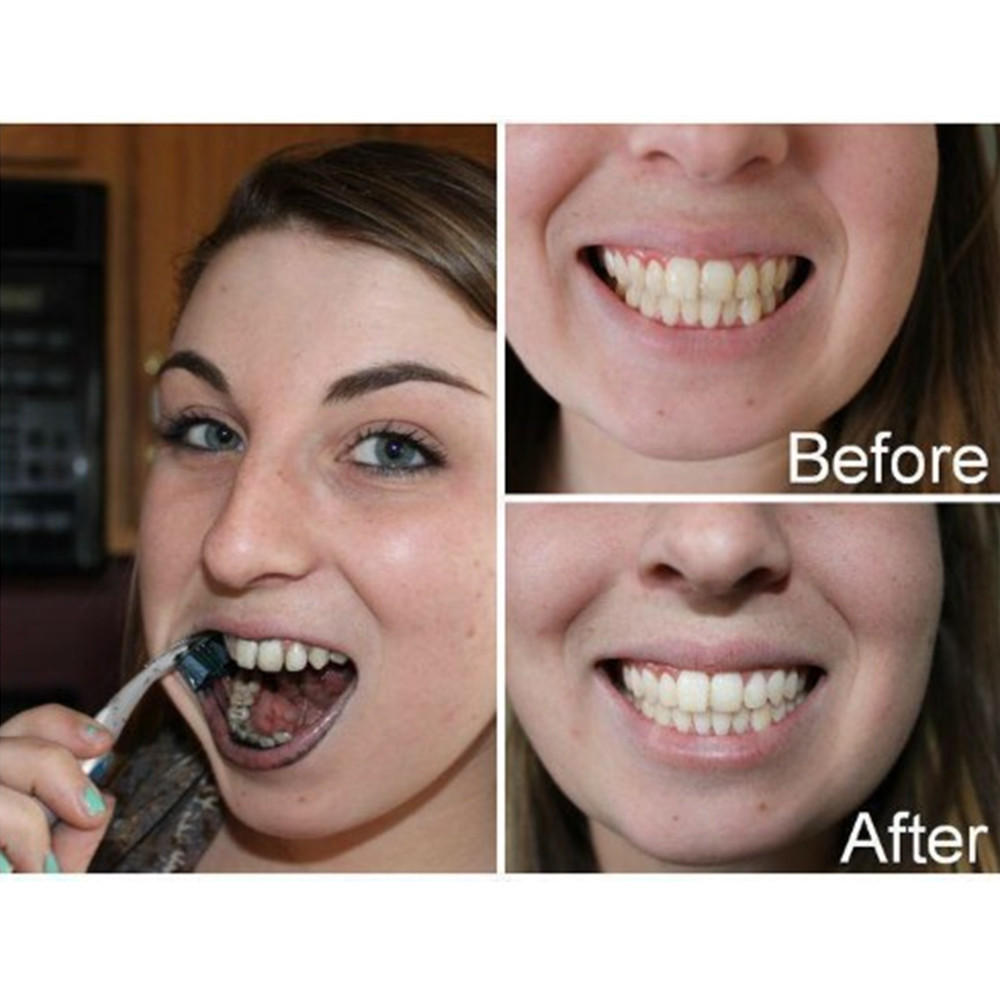 Bamboo Charcoal Teeth Tooth De - Teeth Whitening Filter 리뷰 및 가격