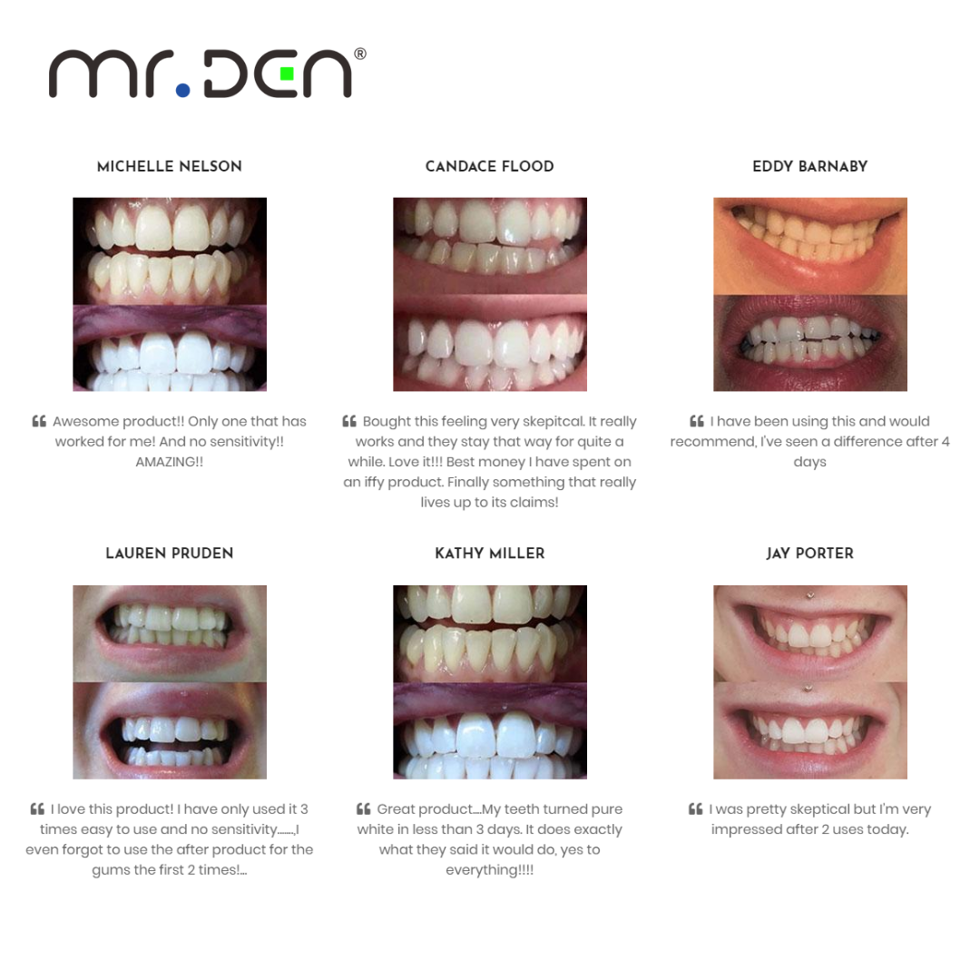 Dr. Whiten 3 Pack Teeth Whiten - Teeth Whitening Kit With Light 리뷰 및 가격