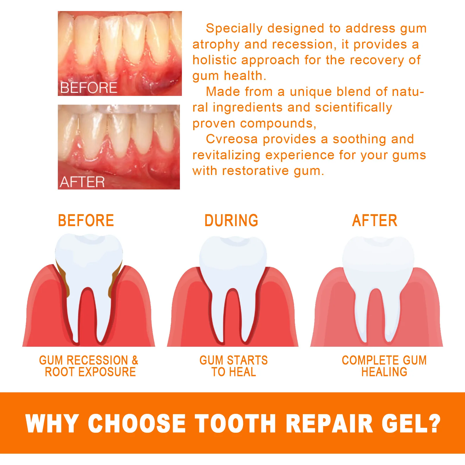 Tooth Gum Serum Repair Anti Gi - Teeth Whitening Filter 리뷰 및 가격