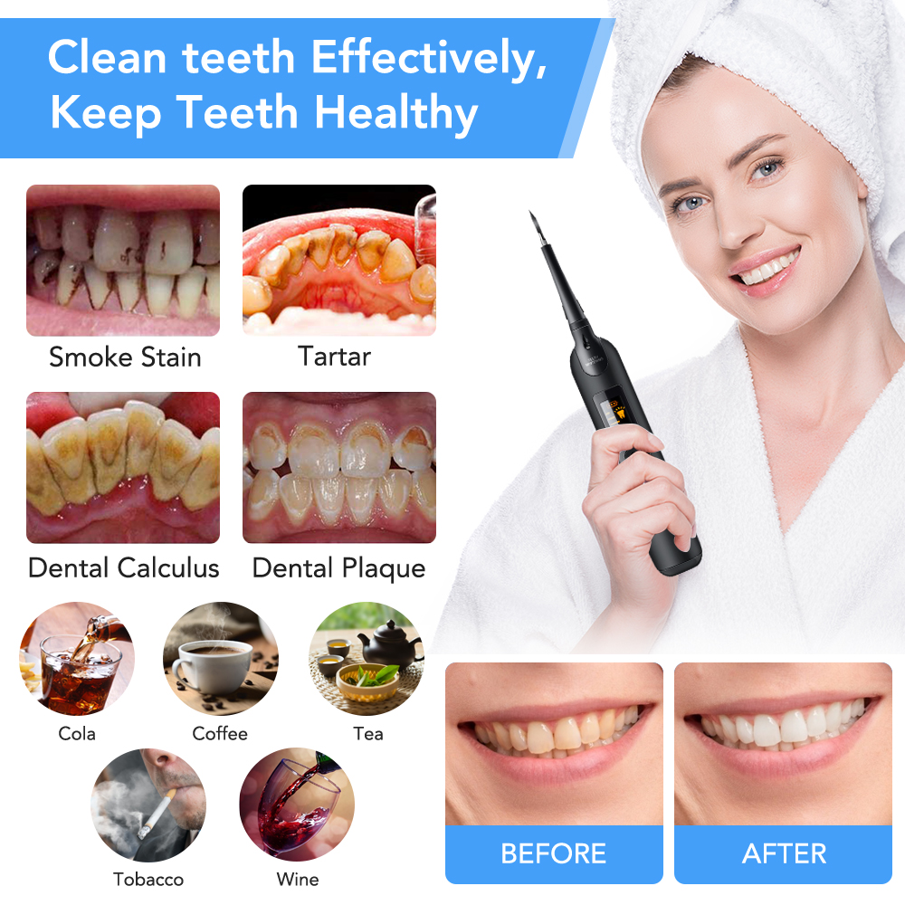 Teeth Tartar Remover Electric  - Teeth Whitening Kit With Light 리뷰 및 가격