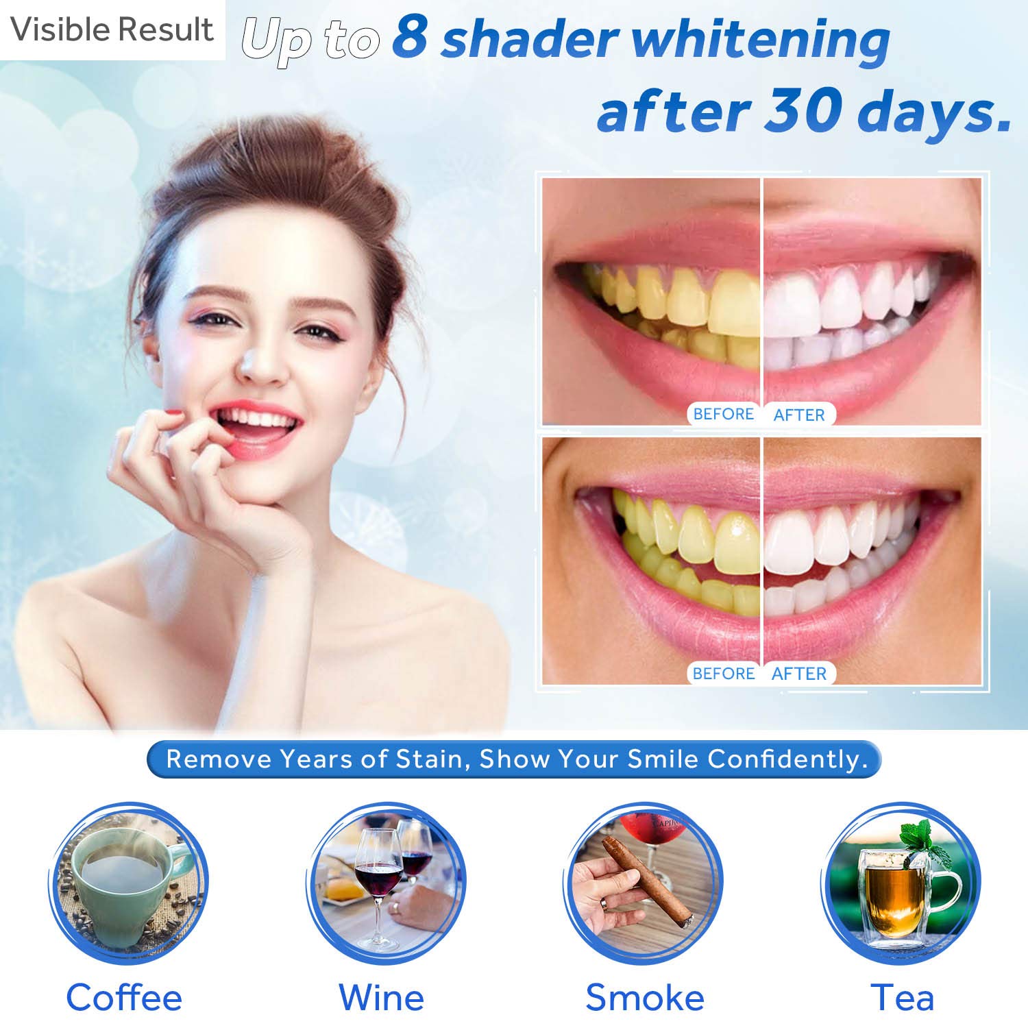 Teeth Whitening Gel Refill Syr - Teeth Whitening Singapore 리뷰 및 가격