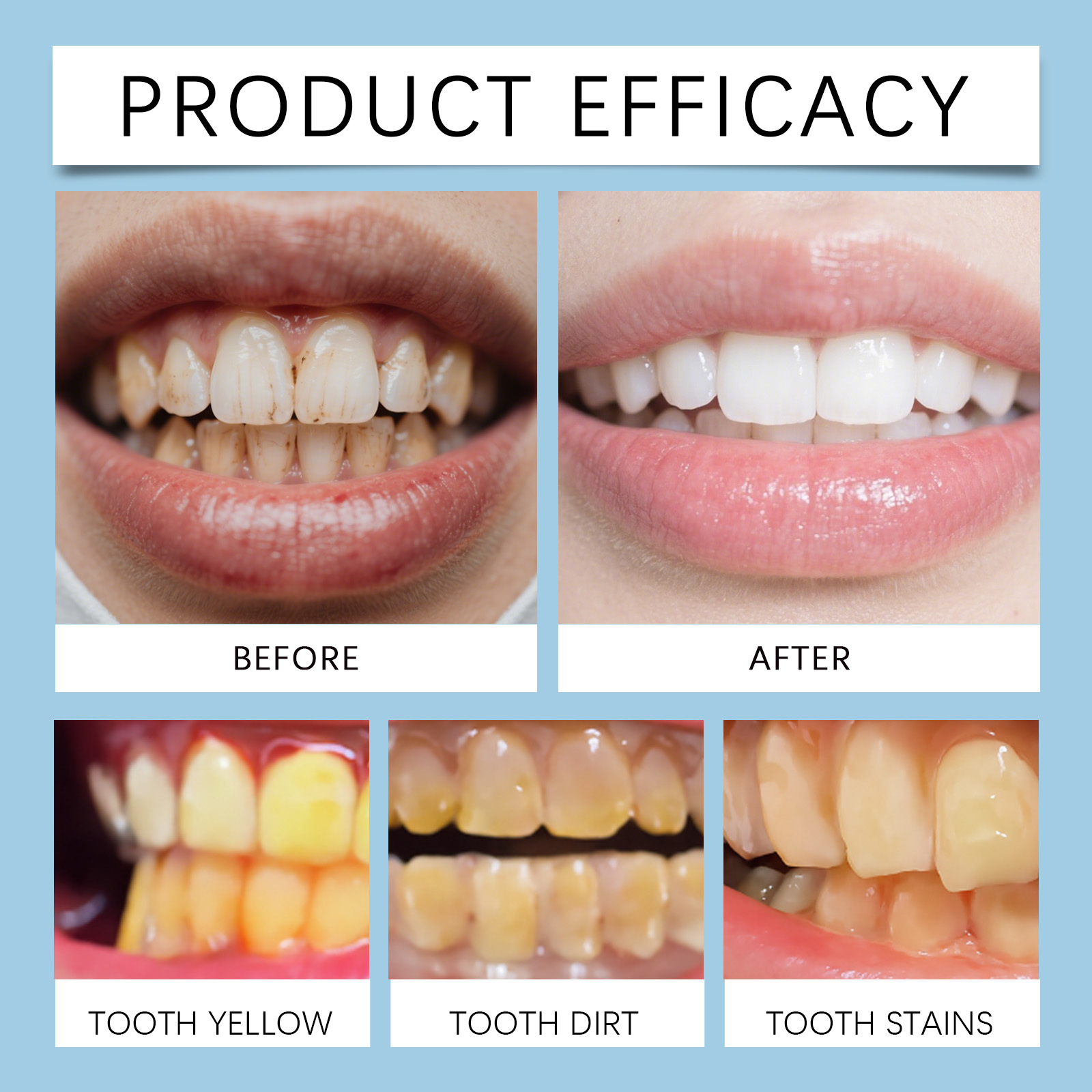 Feimuko 8ml Teeth Gel Pen Gent - Teeth Whitening Singapore 리뷰 및 가격