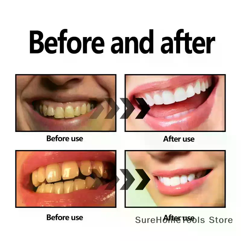 Bamboo Charcoal Powder For Tee - Teeth Whitening Filter 리뷰 및 가격