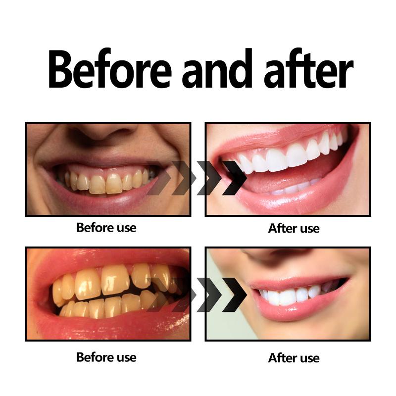 Bamboo Charcoal Powder For Tee - Teeth Whitening Filter 리뷰 및 가격