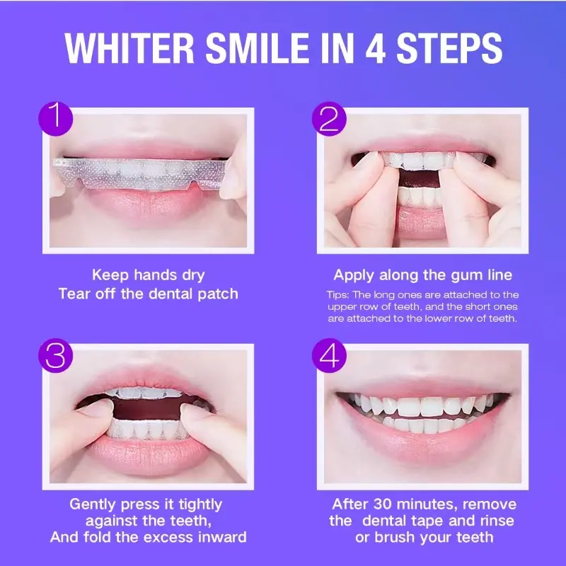 Teeth Whitening Kit - 5X LED L - Teeth Whitening Singapore 리뷰 및 가격