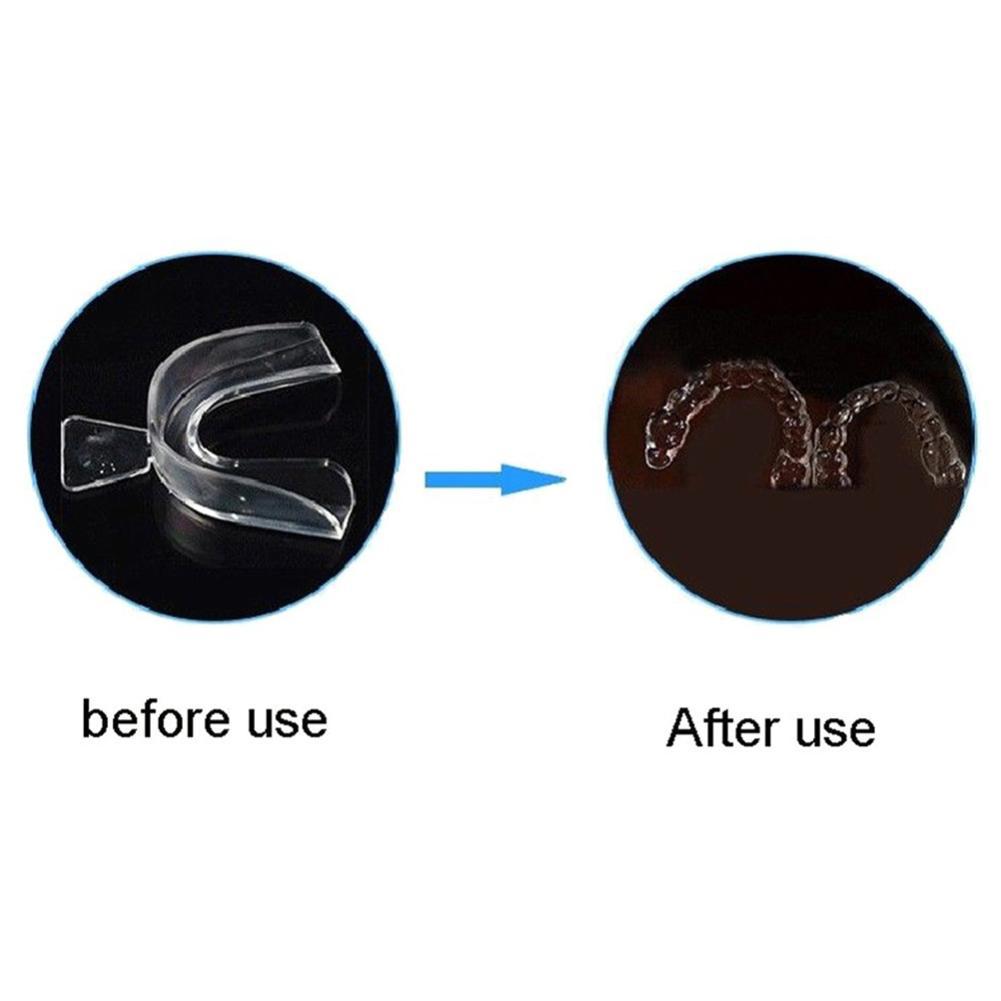 Silicone Mouth Guard Orthodont - Teeth Whitening Mouth Guard 리뷰 및 가격