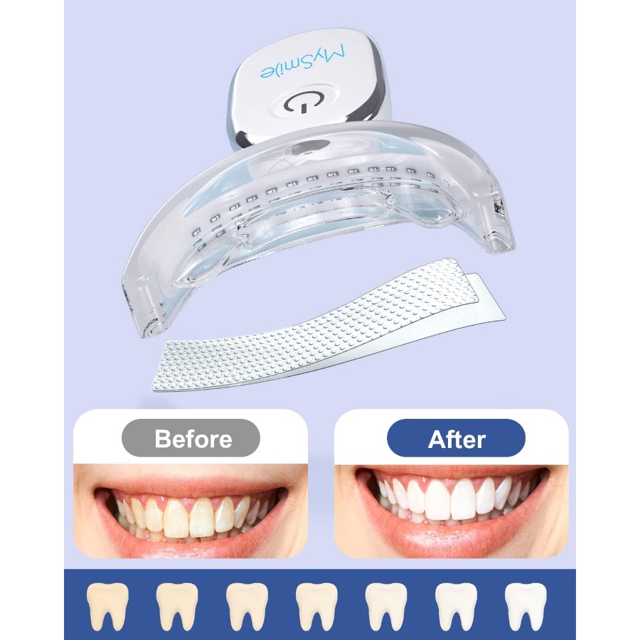 Teeth Whitening Strips Kit wit - Teeth Whitening Kit With Light 리뷰 및 가격