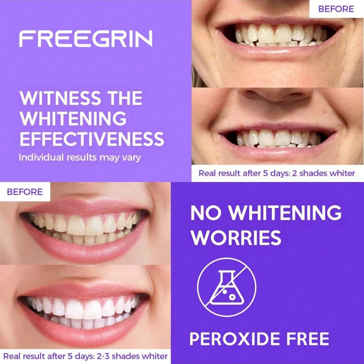 Deluxe Whitening Teeth Sticker - Teeth Whitening Singapore 리뷰 및 가격