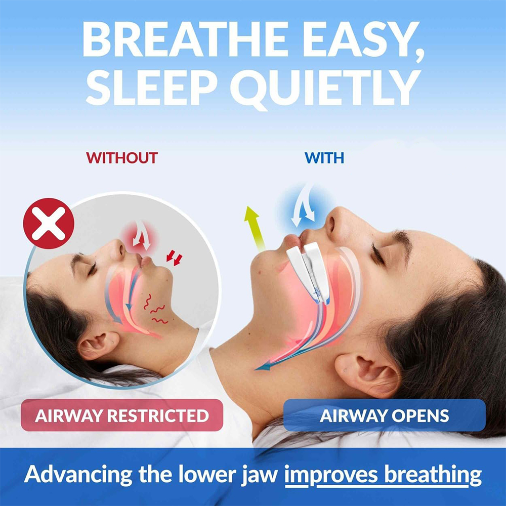 Anti-Snoring Mouthpiece Anti-S - Teeth Whitening Mouth Guard 리뷰 및 가격