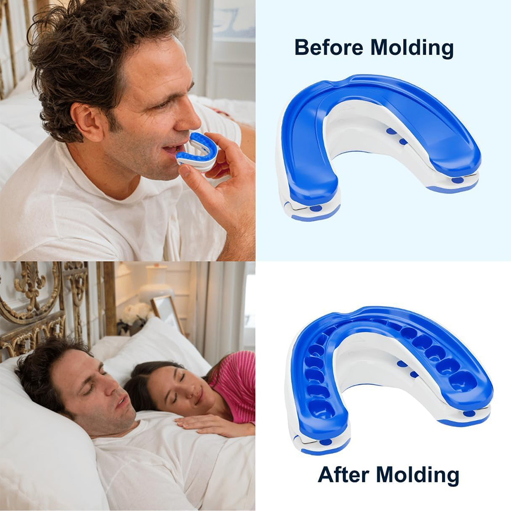 Anti-Snoring Mouthpiece Anti-S - Teeth Whitening Mouth Guard 리뷰 및 가격