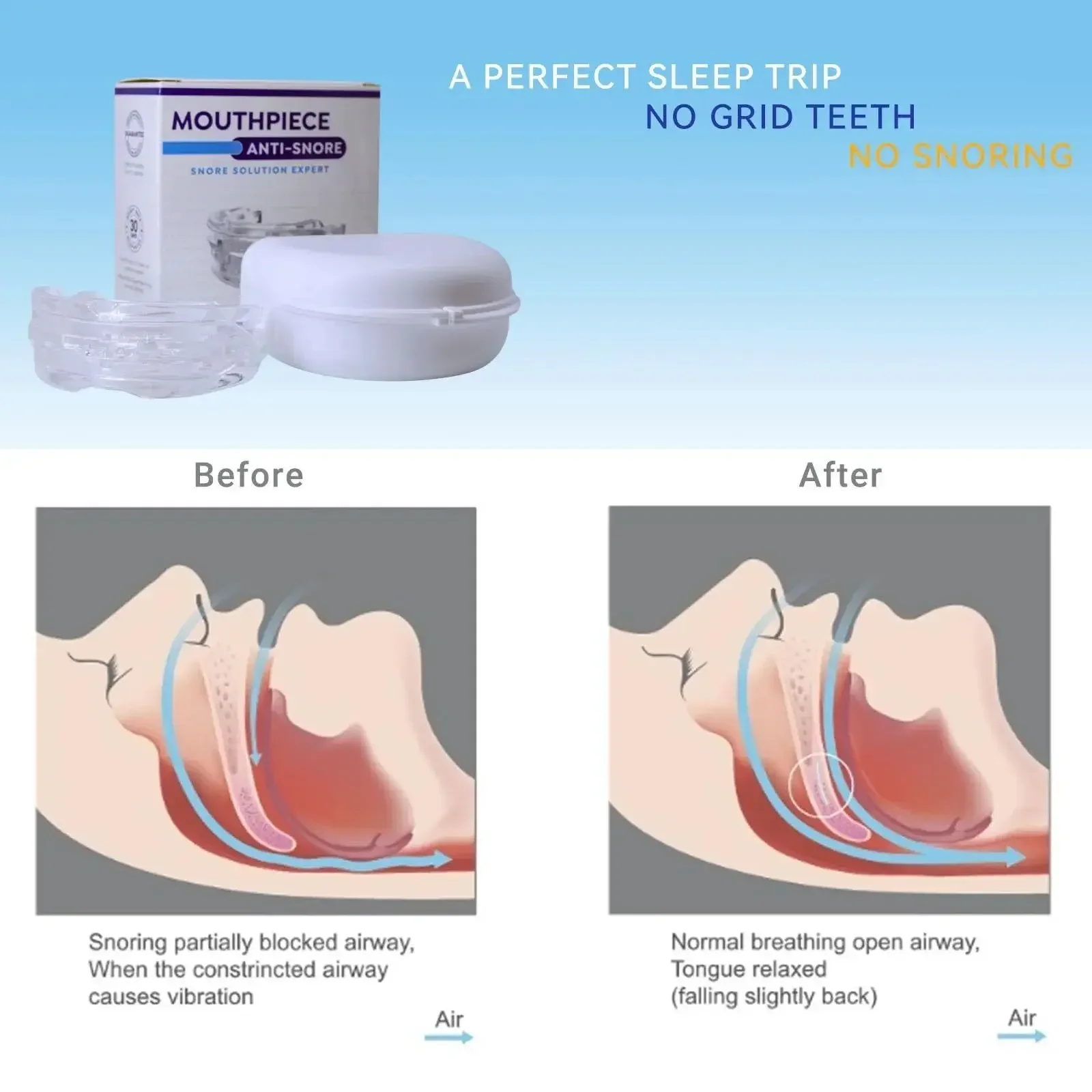 Adjustable Mouthpiece  Anti-Sn - Teeth Whitening Mouth Guard 리뷰 및 가격