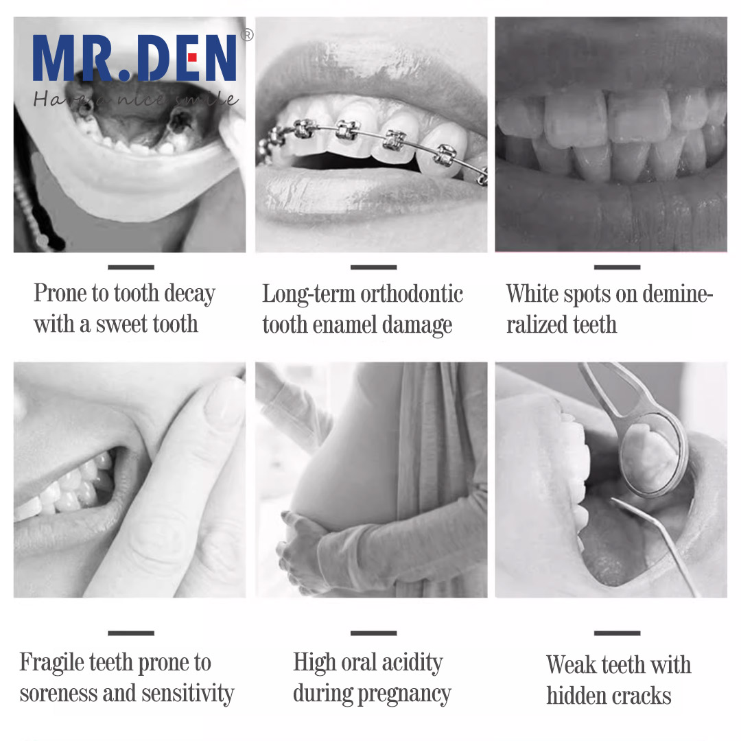 Japan GC Fluoride Enhanced Den - Teeth Whitening Japan 리뷰 및 가격