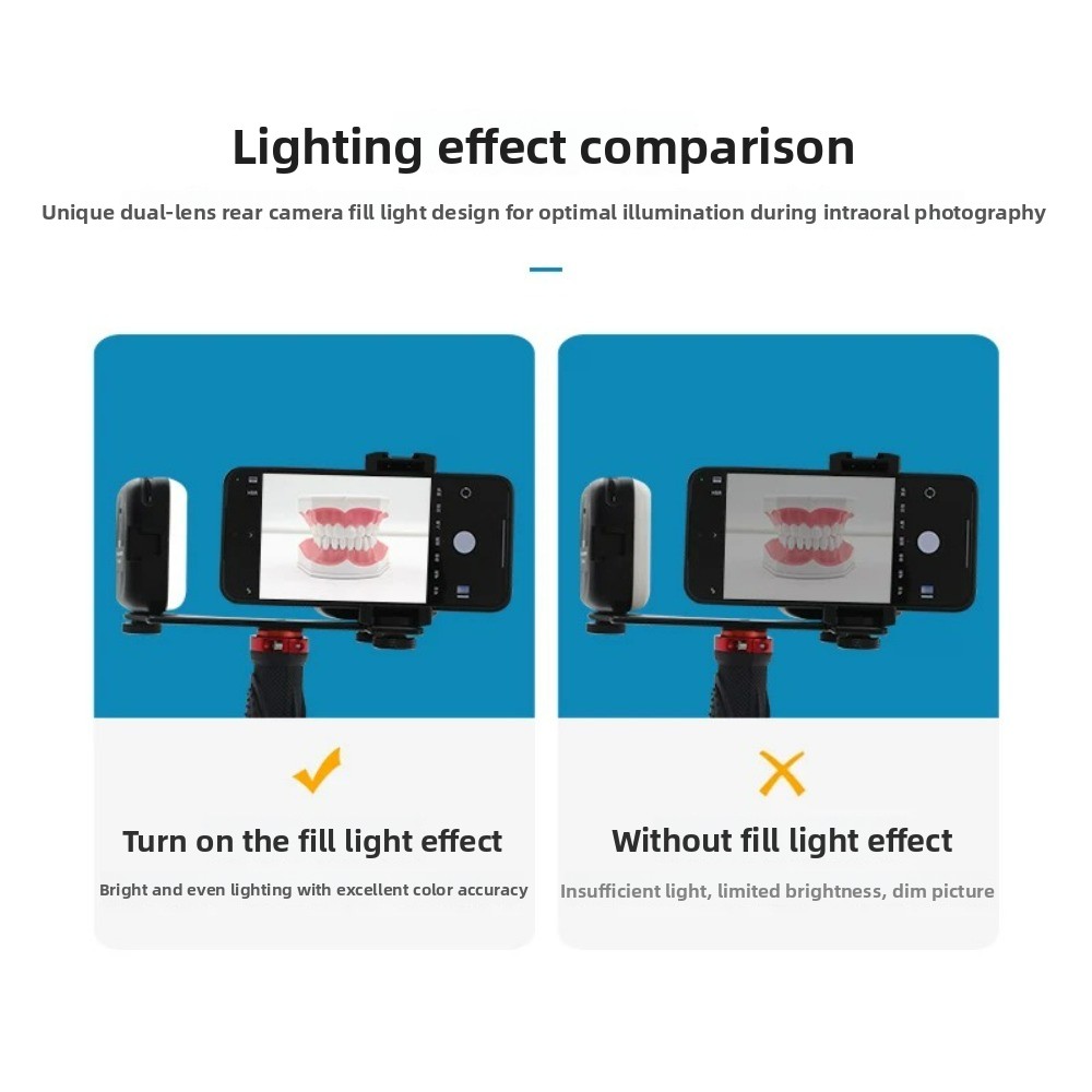 Dental Photography Light, Blue - Teeth Whitening Kit With Light 리뷰 및 가격