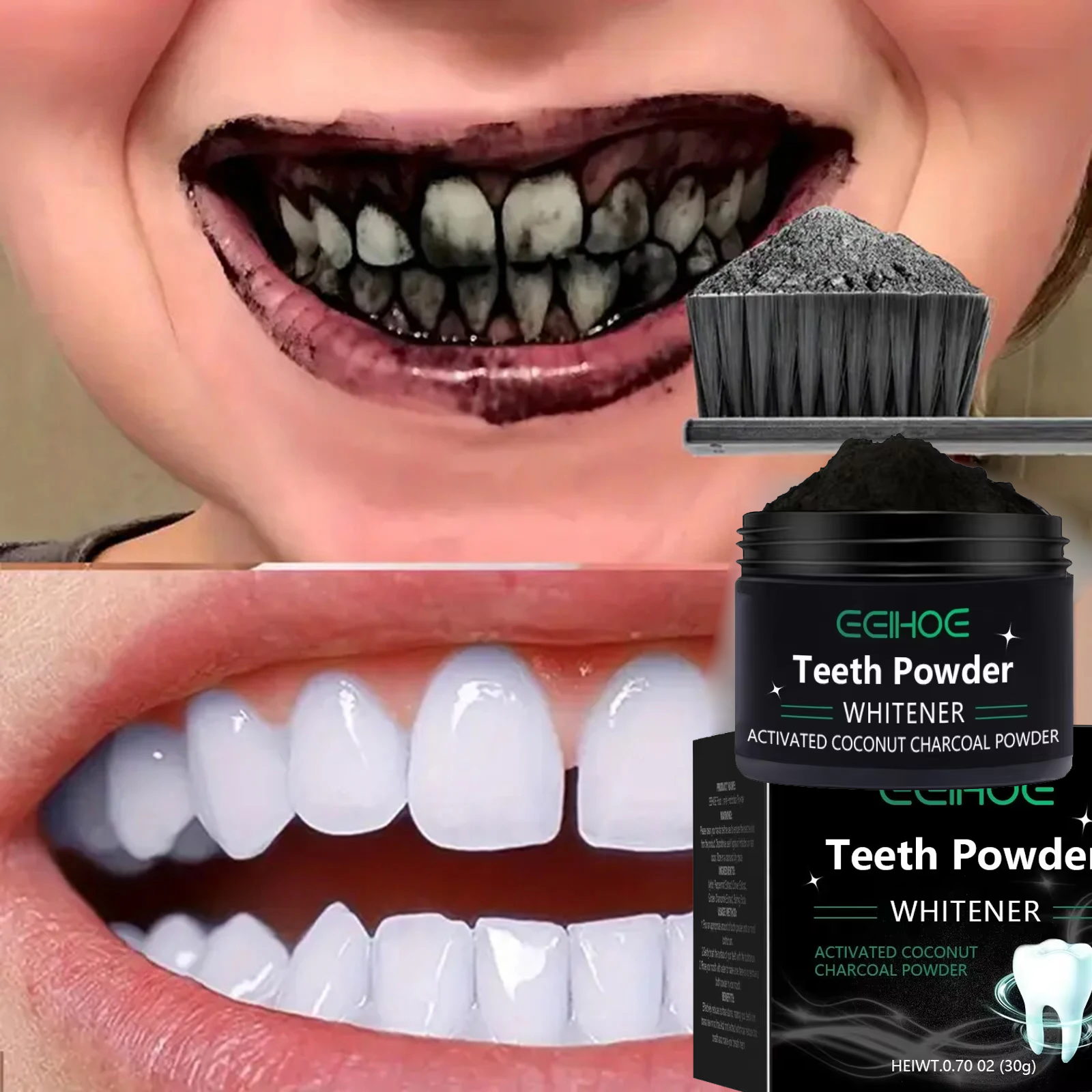 Teeth Brightening Whitening Po - Teeth Whitening Singapore 리뷰 및 가격