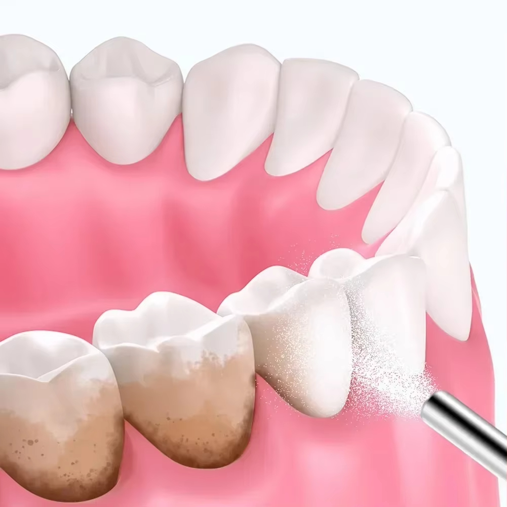 Dental Sandblasting Powder 500 - Teeth Whitening Zimba 리뷰 및 가격